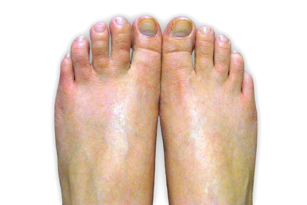 Feet with trimmed nails that are unpainted.