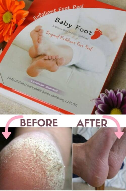 homemade foot exfoliate peel