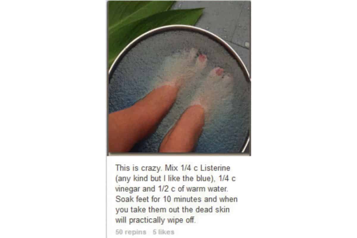 Listerine foot bath sale to remove dead skin